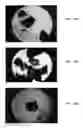 Fig. 09 - Bone graft materials  and methods