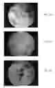 Fig. 10 - Bone graft materials  and methods
