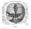 Fig. 06 - Compositions and Methods for Improving Prognosis of a Human with Subarachnoid Hemorrhage