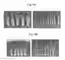 Fig. 04 - Celery morphology