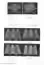 Fig. 05 - Deformation-based micro surface texturing system