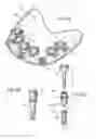 Fig. 04 - Surgical drill guide and index system