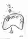 Fig. 08 - Surgical drill guide and index system
