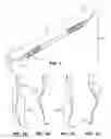 Fig. 02 - PERIODONTAL SCALER