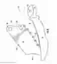 Fig. 05 - Dental wedge with tooth guard and method of restoring a tooth using the same