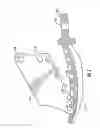 Fig. 08 - Dental wedge with tooth guard and method of restoring a tooth using the same