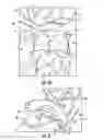 Fig. 10 - Dental wedge with tooth guard and method of restoring a tooth using the same
