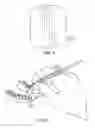 Fig. 03 - Dental fulcrum