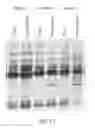Fig. 10 - AFFINITY CAPTURE OF CIRCULATING BIOMARKERS