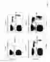 Fig. 03 - Digital Quantification of DNA Methylation