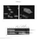 Fig. 05 - METHODS AND MATERIALS FOR IDENTIFYING NODULAR FASCIITIS