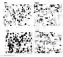 Fig. 01 - Set of oligonucleotide probes as well as methods and uses thereto