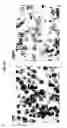 Fig. 03 - Set of oligonucleotide probes as well as methods and uses thereto