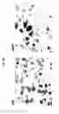 Fig. 07 - Set of oligonucleotide probes as well as methods and uses thereto