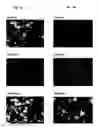 Fig. 10 - Set of oligonucleotide probes as well as methods and uses thereto