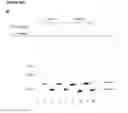 Fig. 46 - Methods and compositions for detection of small RNAs