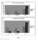 Fig. 03 - METHODS FOR THE DIAGNOSIS OF MULTIPLE SCLEROSIS BASED ON ITS MICRORNA EXPRESSION PROFILING
