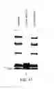 Fig. 94 - Methods To Identify Compounds Useful For The Treatment Of Proliferative And Differentiative Disorders