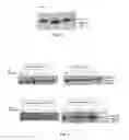 Fig. 03 - Method of detecting botulinum neurotoxin and antibodies that neutralize botulinum neurotoxin action