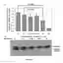 Fig. 11 - Method of detecting botulinum neurotoxin and antibodies that neutralize botulinum neurotoxin action