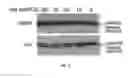 Fig. 19 - Method of detecting botulinum neurotoxin and antibodies that neutralize botulinum neurotoxin action