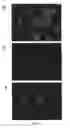 Fig. 20 - Method of detecting botulinum neurotoxin and antibodies that neutralize botulinum neurotoxin action