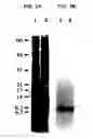 Fig. 04 - METHOD FOR USING A DIAGNOSTIC AGENT WHICH INCLUDES A CALCIUM BINDING PROTEIN ASSAY REAGENT AND ASSAY METHOD FOR CALCIUM BINDING PROTEIN