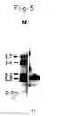 Fig. 06 - METHOD FOR USING A DIAGNOSTIC AGENT WHICH INCLUDES A CALCIUM BINDING PROTEIN ASSAY REAGENT AND ASSAY METHOD FOR CALCIUM BINDING PROTEIN