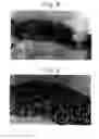 Fig. 08 - METHOD FOR USING A DIAGNOSTIC AGENT WHICH INCLUDES A CALCIUM BINDING PROTEIN ASSAY REAGENT AND ASSAY METHOD FOR CALCIUM BINDING PROTEIN