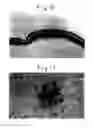 Fig. 09 - METHOD FOR USING A DIAGNOSTIC AGENT WHICH INCLUDES A CALCIUM BINDING PROTEIN ASSAY REAGENT AND ASSAY METHOD FOR CALCIUM BINDING PROTEIN