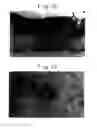Fig. 10 - METHOD FOR USING A DIAGNOSTIC AGENT WHICH INCLUDES A CALCIUM BINDING PROTEIN ASSAY REAGENT AND ASSAY METHOD FOR CALCIUM BINDING PROTEIN