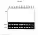 Fig. 26 - Annealing control primer and its uses