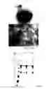 Fig. 15 - METHOD OF PREPARATION OF A BIOLOGICAL PARTICULATE STRUCTURE