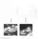 Fig. 06 - Identity profiling of cell surface markers
