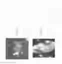 Fig. 07 - Identity profiling of cell surface markers