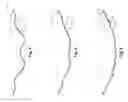 Fig. 03 - Golf ball dimples defined by superposed curves