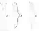 Fig. 04 - Golf ball dimples defined by superposed curves
