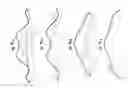 Fig. 06 - Golf ball dimples defined by superposed curves