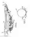 Fig. 03 - Multi-mesh lacrosse head
