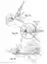 Fig. 11 - Mechanical broadhead
