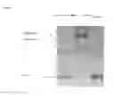 Fig. 10 - DIAGNOSIS OF CANCERS THROUGH GLYCOME ANALYSIS