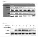 Fig. 04 - METHODS FOR BINDING LEWIS Y ANTIGEN