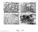 Fig. 13 - Methods for inhibiting peritoneal dissemination of cancer cells