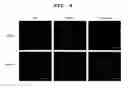 Fig. 09 - Agent for ameliorating blood-brain barrier disorders