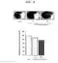 Fig. 11 - Agent for ameliorating blood-brain barrier disorders