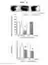 Fig. 12 - Agent for ameliorating blood-brain barrier disorders