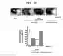 Fig. 13 - Agent for ameliorating blood-brain barrier disorders