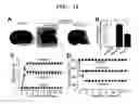 Fig. 15 - Agent for ameliorating blood-brain barrier disorders