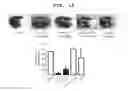 Fig. 16 - Agent for ameliorating blood-brain barrier disorders
