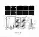 Fig. 04 - Compositions and methods for the treatment of disorders involving epithelial cell apoptosis